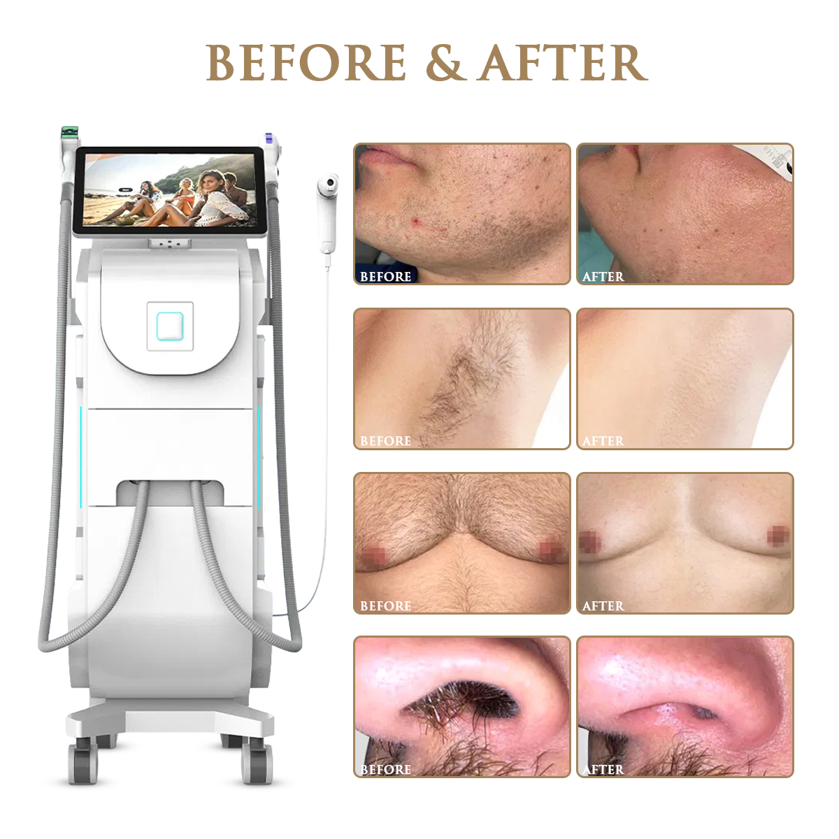 Skin Monarch Quantum Pro diode and picosecond laser device with sleek design and control panel for advanced skin treatments.