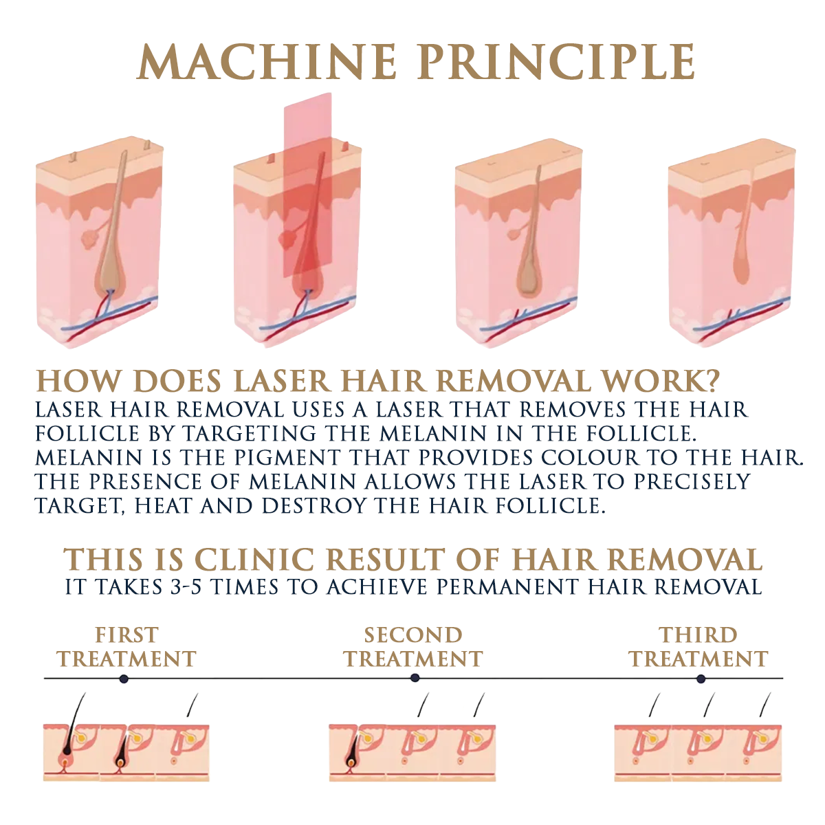 Skin Monarch Quantum Pro diode and picosecond laser device with sleek design and control panel for advanced skin treatments.
