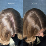 Ινίδια Πύκνωσης Μαλλιών Nanogen Φωτεινό Ξανθό