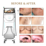 Skin Monarch Quantum Pro diode and picosecond laser device with sleek design and control panel for advanced skin treatments.