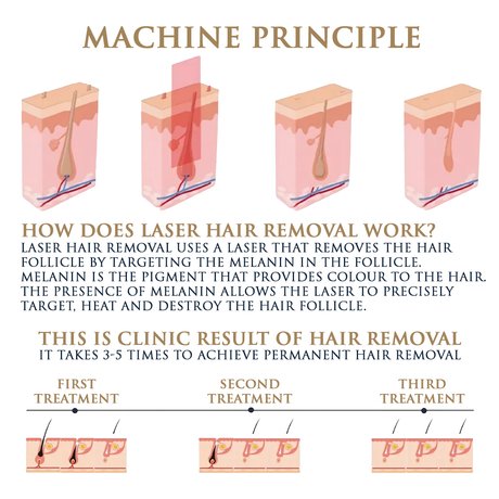 Skin Monarch Quantum Pro diode and picosecond laser device with sleek design and control panel for advanced skin treatments.